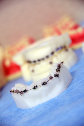 Mikroimplanty i biomechanika w leczeniu ortodontycznym - 09-11 (17)