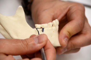 Mikroimplanty i biomechanika w leczeniu ortodontycznym - 09-11 (66)