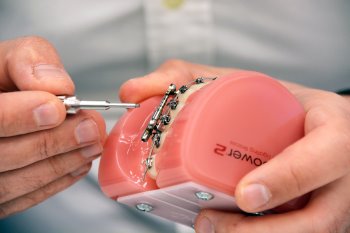 Mikroimplanty i biomechanika w leczeniu ortodontycznym - 09-11 (69)